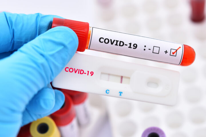 Ce jour en 2020, l'OMS a déclaré la COVID-19 comme une pandémie - et le monde n'a pas encore guéri
